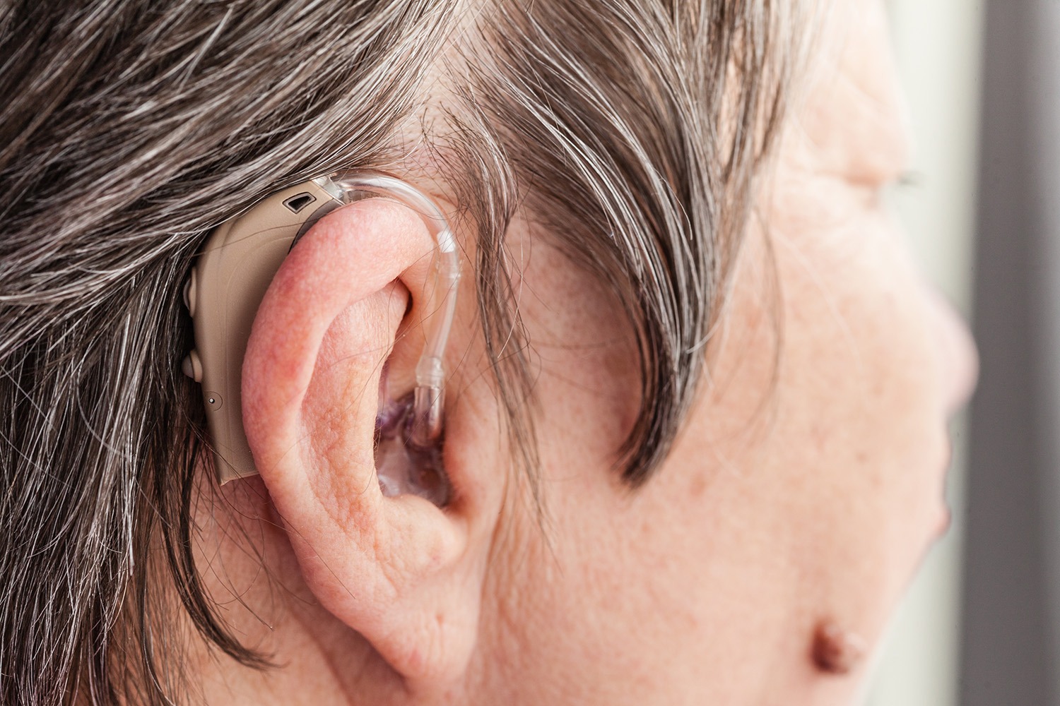 Causes of conductive hearing loss Auditorey