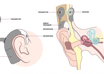 Can conductive hearing loss be treated