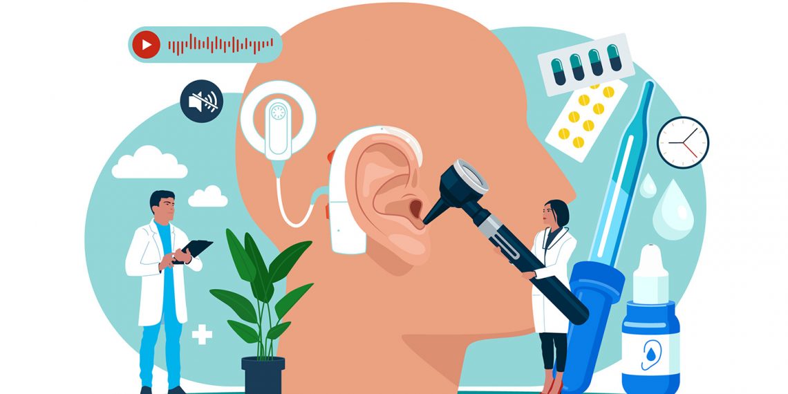 What are cochlear implants?