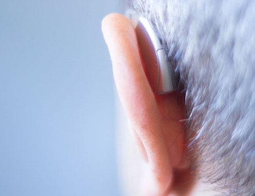 Behind-the-Ear (BTE) Hearing Aid